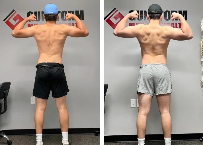 Athletic Optimization transformation